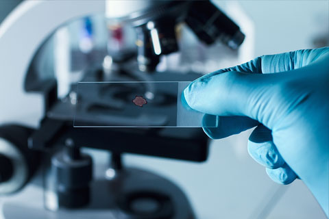 Spécialisation en Oncologie